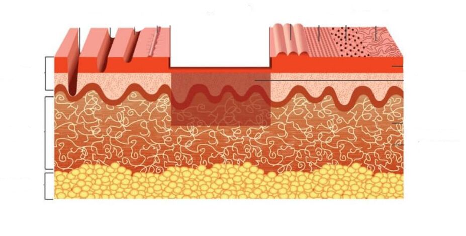 como funciona o laser