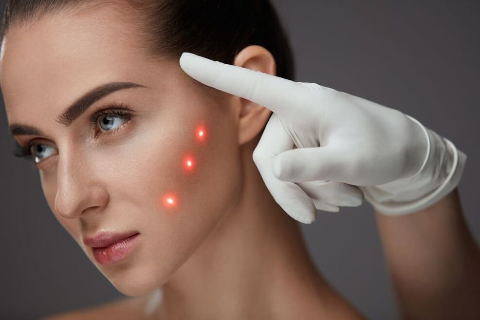 preparação para rejuvenescimento a laser