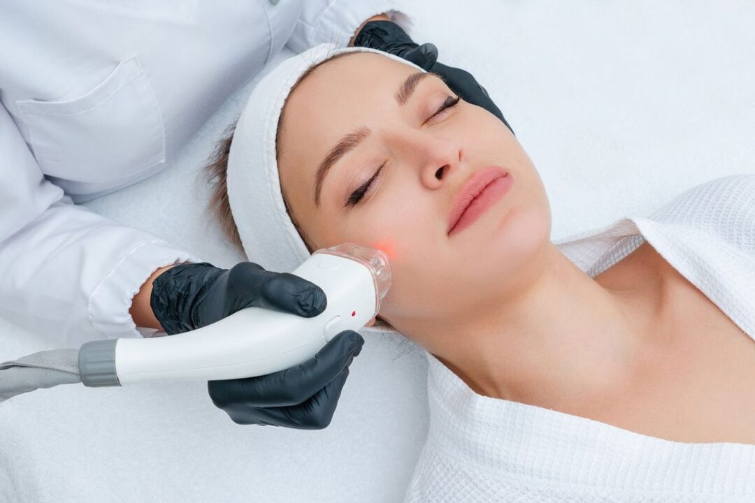 rejuvenescimento facial a laser