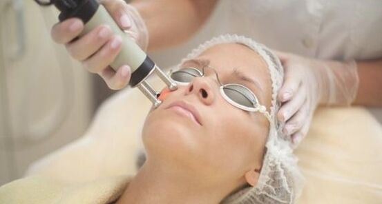 Rejuvenescimento a laser