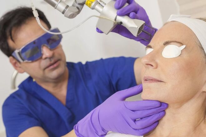 Rejuvenescimento da pele com um laser