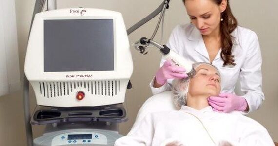 Rejuvenescimento fracionário usando um laser